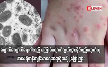 Embedded thumbnail for မျောက်ကျောက်ရောဂါသည် မကြာမီပျောက်ကွယ်သွားနိုင်မည်မဟုတ်ဟု အမေရိကန်ကျန်းမာရေးအရာရှိအချို့ ပြောကြား