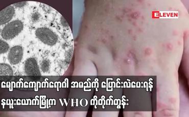 Embedded thumbnail for မျောက်ကျောက်ရောဂါအမည်ကို ပြောင်းလဲပေးရန် နယူးယောက်မြို့က WHO ကိုတိုက်တွန်း