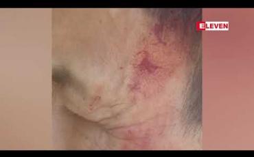 Embedded thumbnail for တောင်ကြီးမြို့ ရတနာသီရိရပ်ကွက် အုပ်ချုပ်ရေးမှူးကို  ကျူးကျော်နေထိုင်သူတစ်ဦးက ဓါးဖြင့်ခုတ်မှုဖြစ်ပွားခဲ့ 