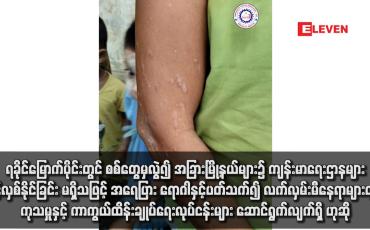 Embedded thumbnail for ရခိုင်မြောက်ပိုင်းတွင် စစ်တွေမှလွဲ၍ အခြားမြို့နယ်များ၌ ကျန်းမာရေးဌာနများ ဖွင့်လှစ်နိုင်ခြင်း မရှိ