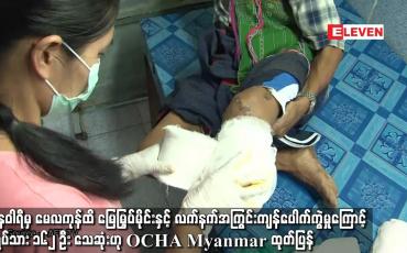 Embedded thumbnail for စစ်လက်နက်အကြွင်းအကျန်ပေါက်ကွဲမှုကြောင့် အရပ်သား ၁၆၂ ဦး သေဆုံးဟု OCHA Myanmar ထုတ်ပြန်