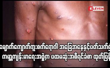 Embedded thumbnail for ကမ္ဘာတစ်ဝန်း၌ မျောက်ကျောက်ကူးစက်ရောဂါ အခြေအနေနှင့်ပတ်သက်၍ ကမ္ဘာ့ကျန်းမာရေးအဖွဲ့က