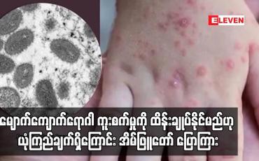 Embedded thumbnail for မျောက်ကျောက်ရောဂါ ကူးစက်မှုကို ထိန်းချုပ်နိုင်မည်ဟု ယုံကြည်ချက်ရှိကြောင်း အိမ်ဖြူတော် ပြောကြား (ရုပ်သံ)