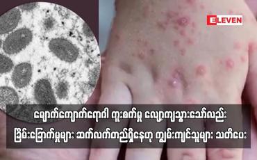 Embedded thumbnail for မျောက်ကျောက်ရောဂါ ကူးစက်မှု လျော့ကျသွားသော်လည်း ခြိမ်းခြောက်မှုများ ဆက်လက်တည်ရှိနေ