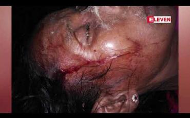 Embedded thumbnail for စားကျက်မြေကျူးကျော်သူနှင့်ကျွဲနွားပိုင်ရှင်များအုပ်စုလိုက်စကားများရန်ဖြစ်ရာမှသုံးဦးဒဏ်ရာရပြီးတစ်ဦးစိုးရိမ်ရ