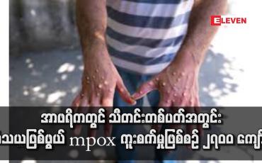Embedded thumbnail for အာဖရိကတွင် သီတင်းတစ်ပတ်အတွင်း သံသယဖြစ်ဖွယ် mpox ကူးစက်မှုဖြစ်စဉ် ၂၇၀၀ ကျော်ရှိ