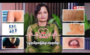 Embedded thumbnail for နွေရာသီမှာအဖြစ်များတဲ့ရောဂါများ ( ရုပ်သံအစီအစဉ် )