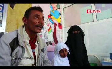 Embedded thumbnail for ပြည်တွင်းစစ်ကြောင့် ယီမင်ပြည်သူ သန်း ၂၀ နီးပါး အစားအစာမလုံလောက်မှုနှင့် ကြုံတွေ့နေ 