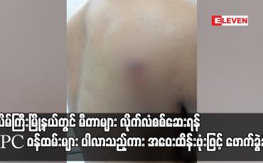 Embedded thumbnail for ပုသိမ်ကြီးမြို့နယ်တွင် မီတာများ လိုက်လံစစ်ဆေးရန် EPC ဝန်ထမ်းများပါလာသည့်ကား အဝေးထိန်းဗုံးဖြင့်