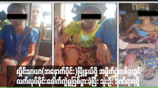 Embedded thumbnail for လှိုင်သာယာ(အနောက်ပိုင်း)မြို့နယ်ရှိ အမှိုက်ပုံတစ်ခုတွင် လက်လုပ်မိုင်းပေါက်ကွဲမှုဖြစ်ပွားခဲ့ပြီး အမှိုက်ကောက်နေသူ သုံးဦး ဒဏ်ရာရရှိ