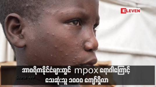 Embedded thumbnail for အာဖရိကနိုင်ငံများတွင် mpox ရောဂါကြောင့် သေဆုံးသူ ၁၀၀၀ ကျော်ရှိလာ