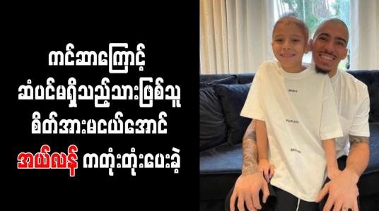 Embedded thumbnail for ကင်ဆာကြောင့် ဆံပင်မရှိသည့်သားဖြစ်သူ စိတ်အားမငယ်အောင် အယ်လန် ကတုံးတုံးပေးခဲ့