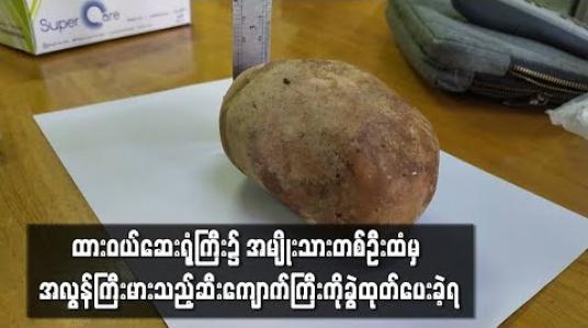 Embedded thumbnail for ထားဝယ်ပြည်သူ့ဆေးရုံကြီး၌ အသက် ၅၆ နှစ်အရွယ်အမျိုးသားတစ်ဦးထံမှ အလျား ၅ လက်မခွဲ၊ အနံ ၃ လက်မခွဲနှင့် အမြင့် ၃ လက်မခန့် အရွယ်ရှိ ဆီးကျောက်ကြီးကို ခွဲထုတ်ပေးခဲ့ရ
