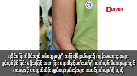 Embedded thumbnail for ရခိုင်မြောက်ပိုင်းတွင် စစ်တွေမှလွဲ၍ အခြားမြို့နယ်များ၌ ကျန်းမာရေးဌာနများ ဖွင့်လှစ်နိုင်ခြင်း မရှိ