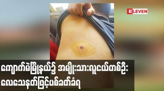 Embedded thumbnail for ကျောက်မဲမြို့နယ်၌အမျိုးသားလူငယ်တစ်ဦး လေသေနတ်ဖြင့်ပစ်ခတ်ခံရ