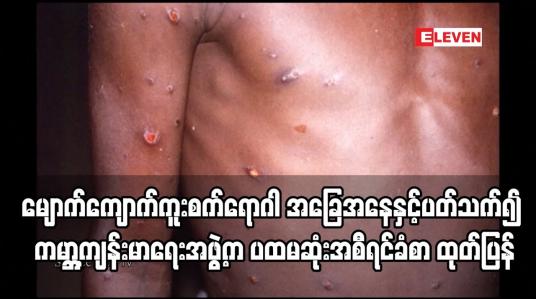Embedded thumbnail for ကမ္ဘာတစ်ဝန်း၌ မျောက်ကျောက်ကူးစက်ရောဂါ အခြေအနေနှင့်ပတ်သက်၍ ကမ္ဘာ့ကျန်းမာရေးအဖွဲ့က