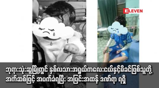 Embedded thumbnail for ဘုရားသုံးဆူမြို့တွင် နှစ်လသားအရွယ် ကလေးငယ်နှင့်မိခင်ဖြစ်သူတို့ အက်ဆစ်ဖြင့် အပက်ခံရပြီး အပြင်းအထန် ဒဏ်ရာရရှိ