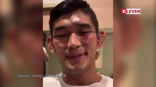 Embedded thumbnail for အားပေးသူပရိသတ်များကို အောင်လအန်ဆန် ကျေးဇူးတင်စကားဆို