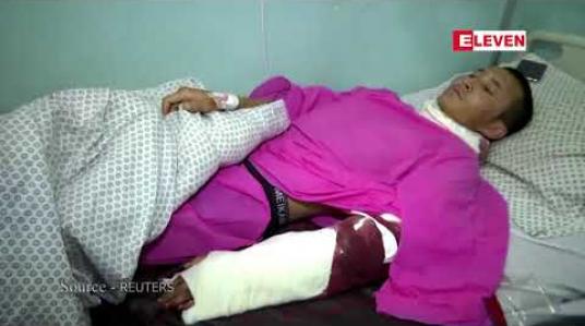Embedded thumbnail for အာဖဂန်နစ္စတန်ရှိ ကဘူးတက္ကသိုလ်ကို သေနတ်သမားများ ဝင်ရောက်စီးနင်း တိုက်ခိုက်ခဲ့သဖြင့် ၂၂ ဦးထက်မနည်း သေဆုံး 