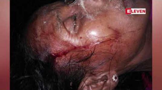 Embedded thumbnail for စားကျက်မြေကျူးကျော်သူနှင့်ကျွဲနွားပိုင်ရှင်များအုပ်စုလိုက်စကားများရန်ဖြစ်ရာမှသုံးဦးဒဏ်ရာရပြီးတစ်ဦးစိုးရိမ်ရ