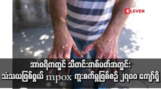 Embedded thumbnail for အာဖရိကတွင် သီတင်းတစ်ပတ်အတွင်း သံသယဖြစ်ဖွယ် mpox ကူးစက်မှုဖြစ်စဉ် ၂၇၀၀ ကျော်ရှိ